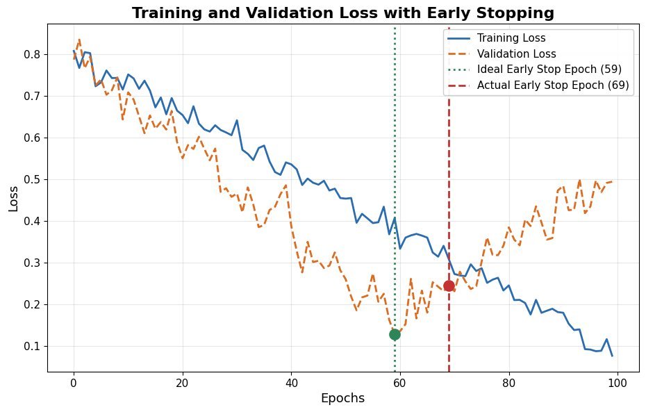 Training loss keeps decreasing while validation loss bottoms out at epoch 60 and rises again, with the actual stop at epoch 70 under patience 10